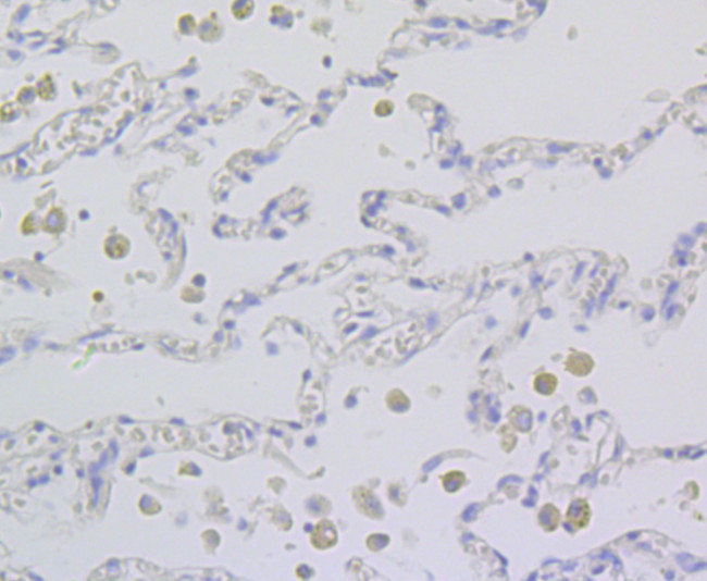 TESPA1 Antibody in Immunohistochemistry (Paraffin) (IHC (P))