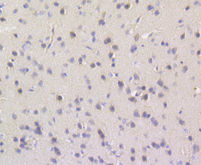 TESPA1 Antibody in Immunohistochemistry (Paraffin) (IHC (P))