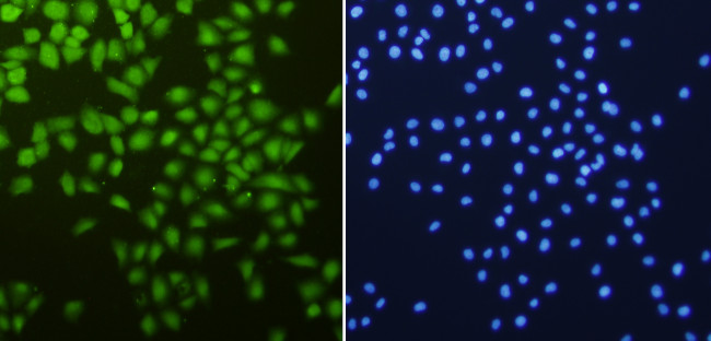 CDK2 Antibody in Immunocytochemistry (ICC/IF)