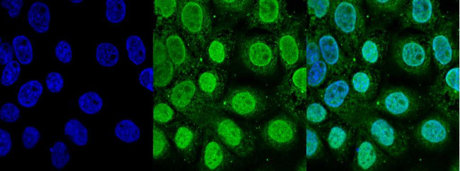 TOP2A Antibody in Immunocytochemistry (ICC/IF)