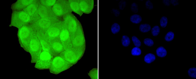 TCF7L2 Antibody in Immunocytochemistry (ICC/IF)