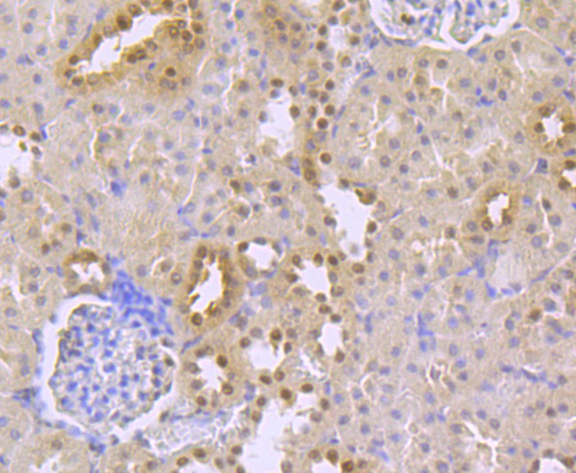 TCF7L2 Antibody in Immunohistochemistry (Paraffin) (IHC (P))