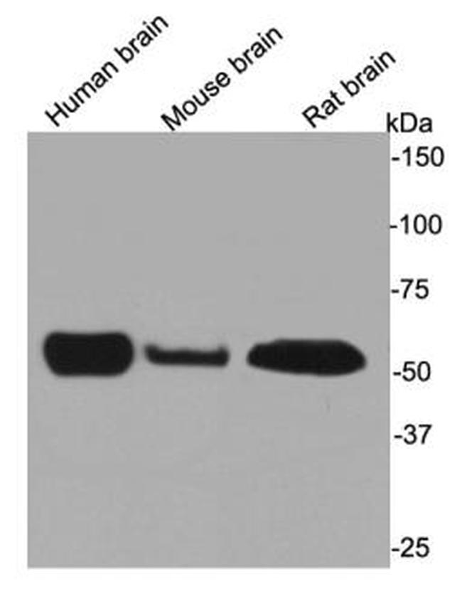 Beta III Tubulin Antibody in Western Blot (WB)