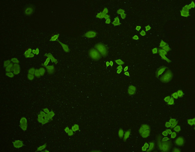 GLUT4 Antibody in Immunocytochemistry (ICC/IF)