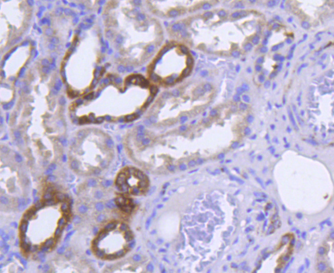 GLUT4 Antibody in Immunohistochemistry (Paraffin) (IHC (P))