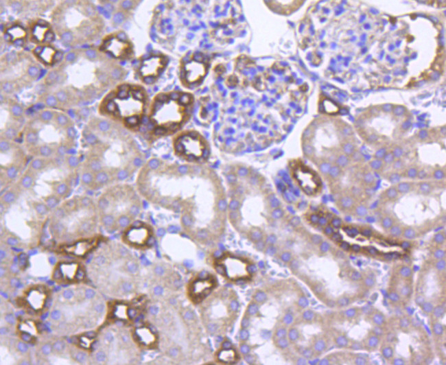 GLUT4 Antibody in Immunohistochemistry (Paraffin) (IHC (P))