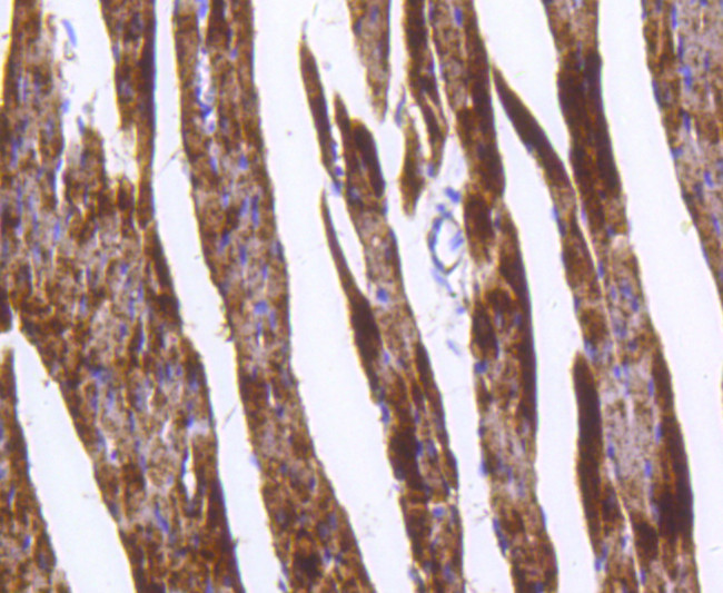 GLUT4 Antibody in Immunohistochemistry (Paraffin) (IHC (P))