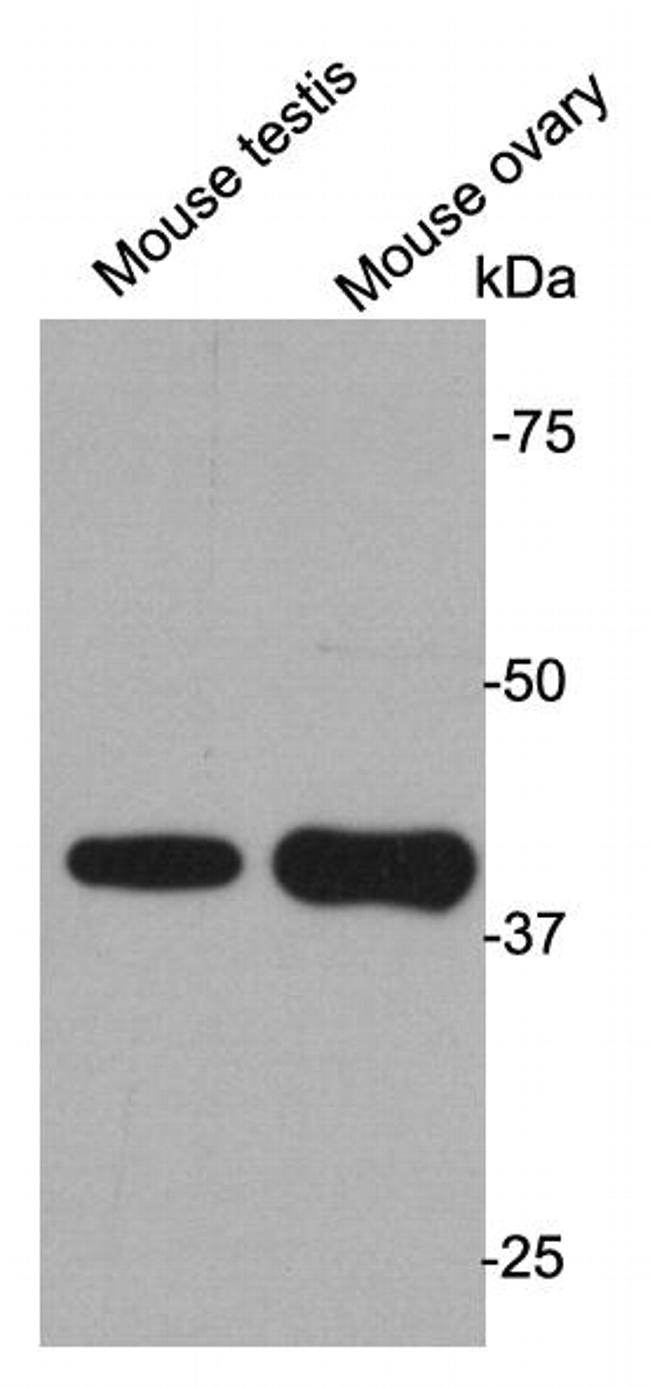 L1ORF1p Antibody in Western Blot (WB)