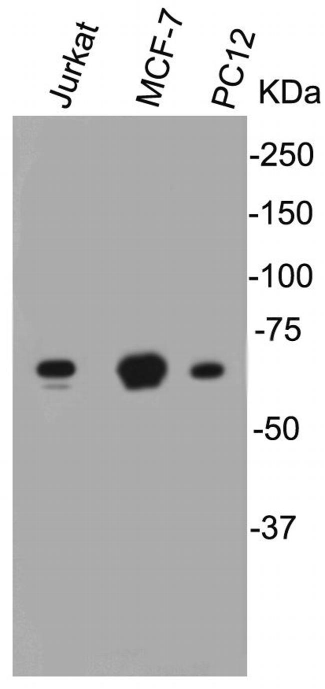 Lamin B1 Antibody in Western Blot (WB)