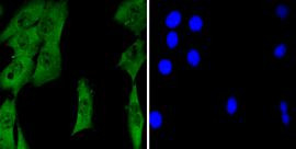 TET1 Antibody in Immunocytochemistry (ICC/IF)