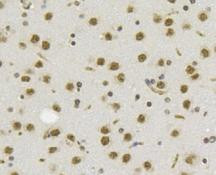 TET1 Antibody in Immunohistochemistry (Paraffin) (IHC (P))