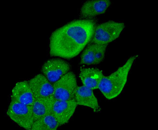 TSC2 Antibody in Immunocytochemistry (ICC/IF)