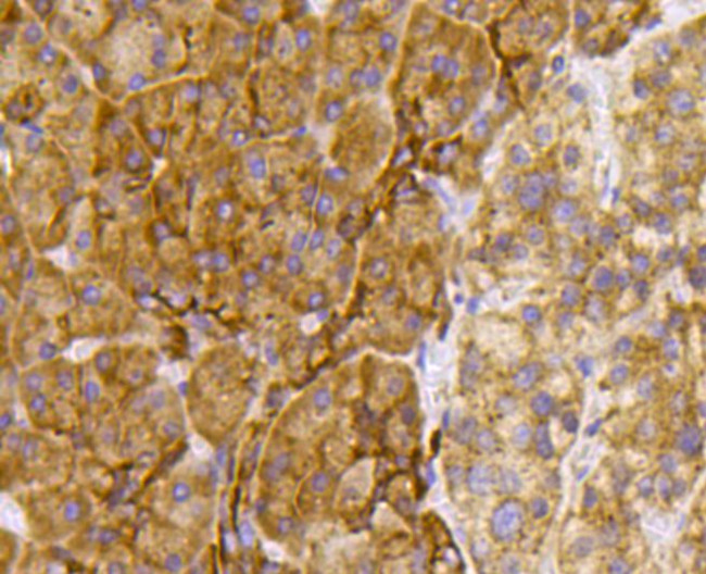 TSC2 Antibody in Immunohistochemistry (Paraffin) (IHC (P))