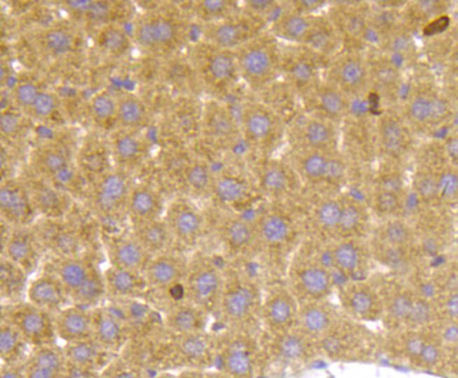 TSC2 Antibody in Immunohistochemistry (Paraffin) (IHC (P))