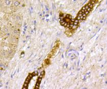 TSC2 Antibody in Immunohistochemistry (Paraffin) (IHC (P))