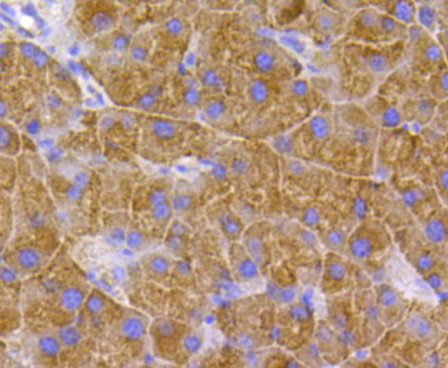 TSC2 Antibody in Immunohistochemistry (Paraffin) (IHC (P))