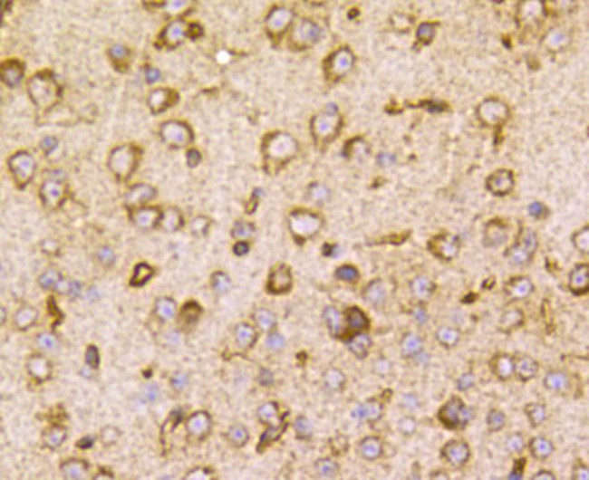 TSC2 Antibody in Immunohistochemistry (Paraffin) (IHC (P))