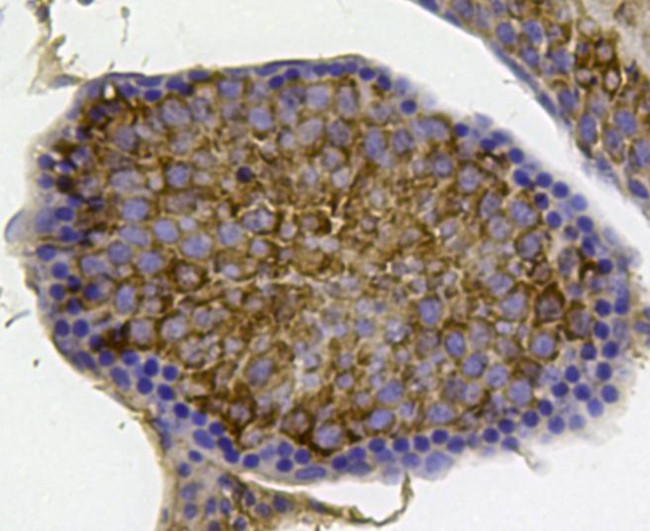 YBX1 Antibody in Immunohistochemistry (Paraffin) (IHC (P))