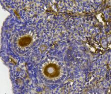 YBX1 Antibody in Immunohistochemistry (Paraffin) (IHC (P))