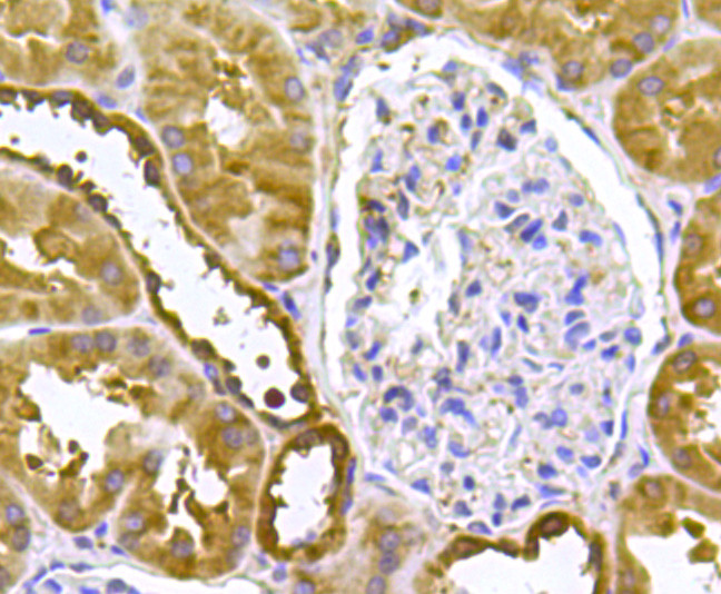 PRDX2 Antibody in Immunohistochemistry (Paraffin) (IHC (P))