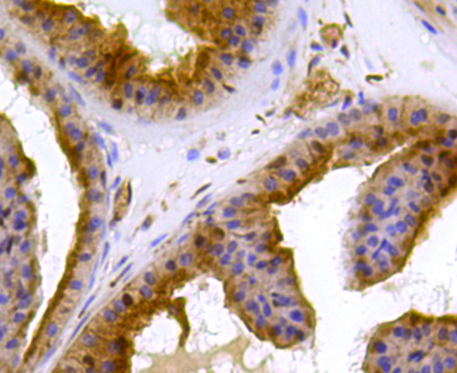 PRDX2 Antibody in Immunohistochemistry (Paraffin) (IHC (P))