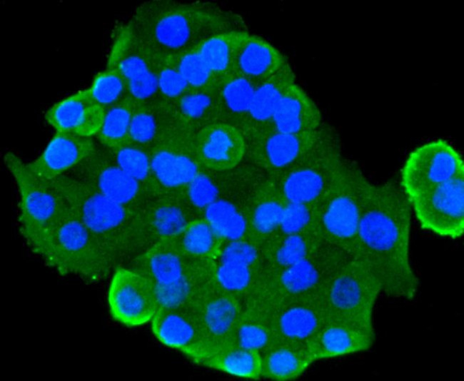 GSK3B Antibody in Immunocytochemistry (ICC/IF)