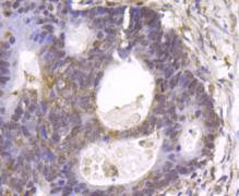 GSK3B Antibody in Immunohistochemistry (Paraffin) (IHC (P))