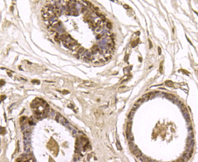 GSK3B Antibody in Immunohistochemistry (Paraffin) (IHC (P))