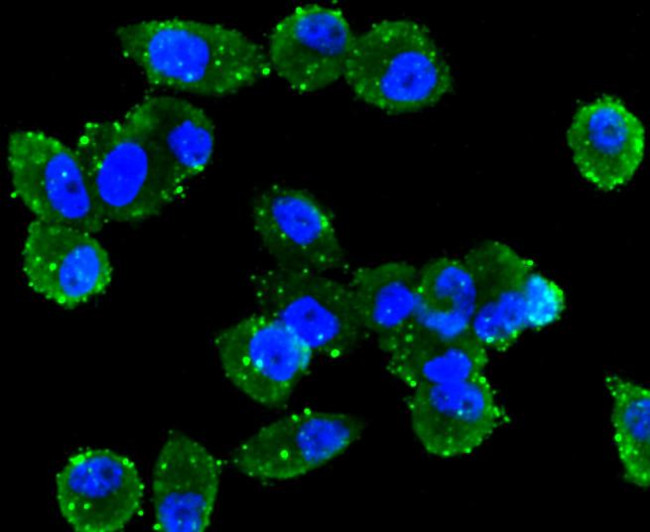 ABCA1 Antibody in Immunocytochemistry (ICC/IF)