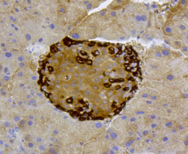 ABCA1 Antibody in Immunohistochemistry (Paraffin) (IHC (P))