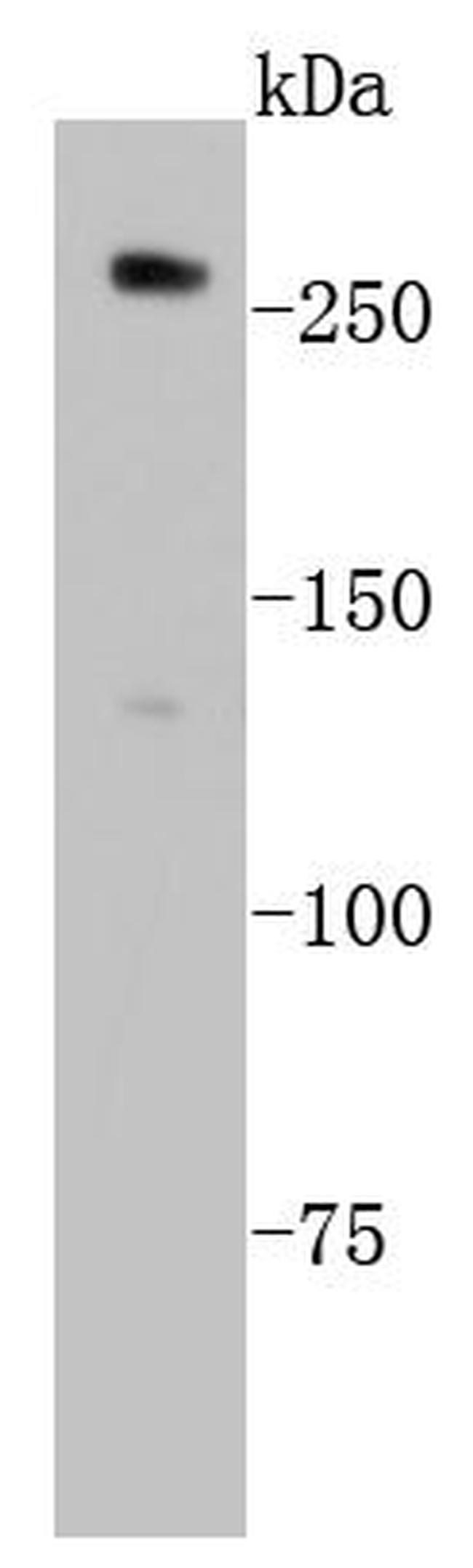 ABCA1 Antibody in Western Blot (WB)