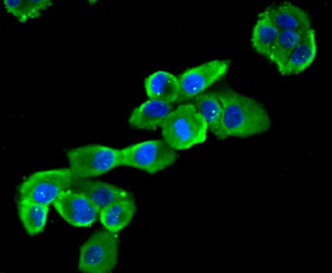 CCL3 (MIP-1 alpha) Antibody in Immunocytochemistry (ICC/IF)