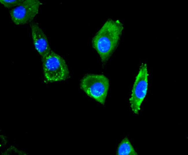 CCL3 (MIP-1 alpha) Antibody in Immunocytochemistry (ICC/IF)