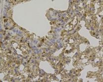 CCL3 (MIP-1 alpha) Antibody in Immunohistochemistry (Paraffin) (IHC (P))