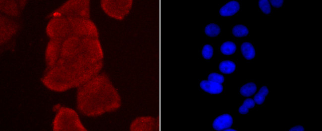 Thioredoxin 1 Antibody in Immunocytochemistry (ICC/IF)