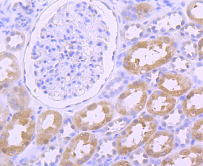 Thioredoxin 1 Antibody in Immunohistochemistry (Paraffin) (IHC (P))