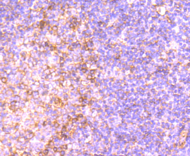 Human IgM Antibody in Immunohistochemistry (Paraffin) (IHC (P))