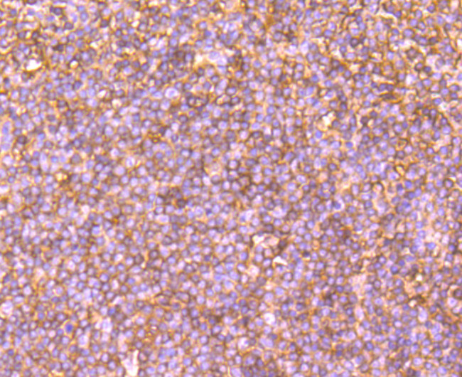 Human IgM Antibody in Immunohistochemistry (Paraffin) (IHC (P))