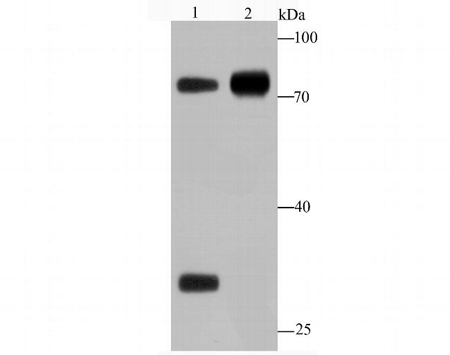 Human IgM Antibody in Western Blot (WB)