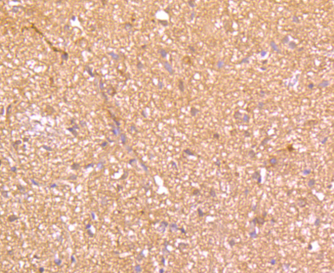 SHP-1 Antibody in Immunohistochemistry (Paraffin) (IHC (P))