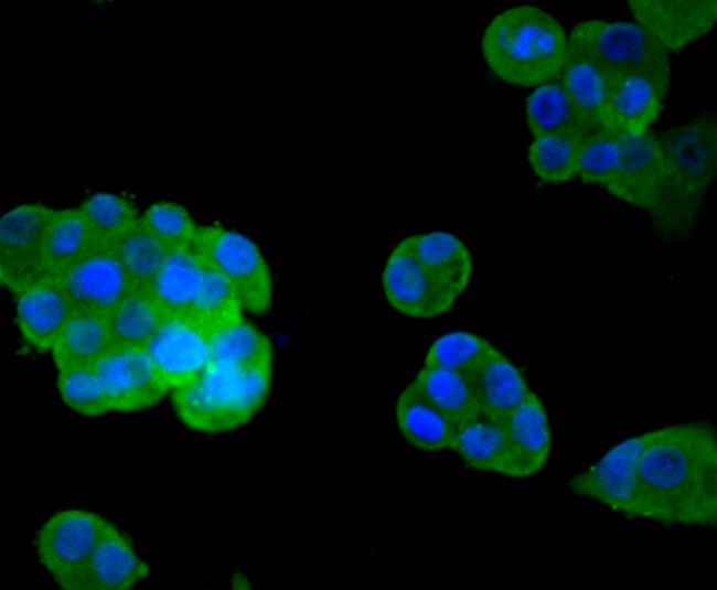 MYLK Antibody in Immunocytochemistry (ICC/IF)