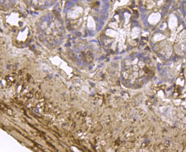 MYLK Antibody in Immunohistochemistry (Paraffin) (IHC (P))