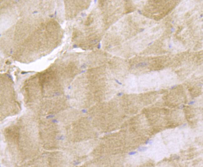 MYLK Antibody in Immunohistochemistry (Paraffin) (IHC (P))