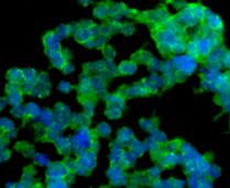 NOX4 Antibody in Immunocytochemistry (ICC/IF)