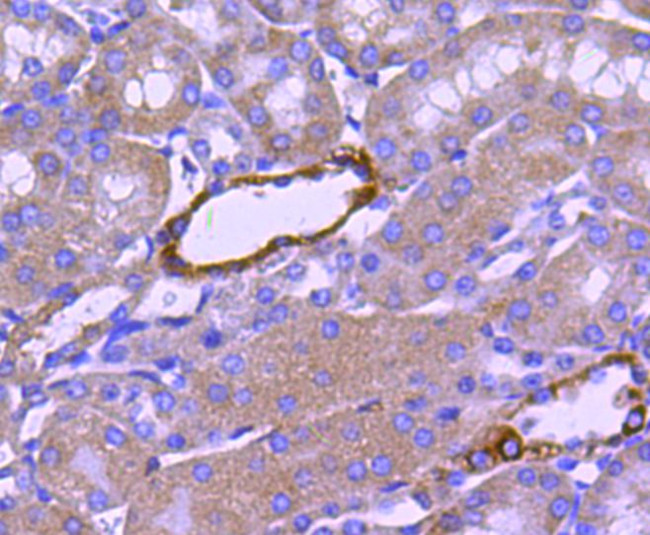 NOX4 Antibody in Immunohistochemistry (Paraffin) (IHC (P))