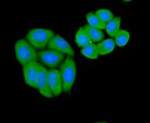 BAD Antibody in Immunocytochemistry (ICC/IF)