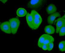 BAD Antibody in Immunocytochemistry (ICC/IF)