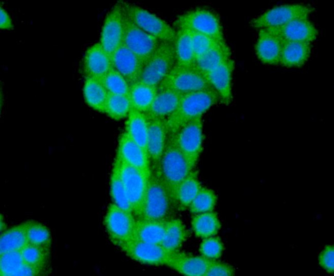 BAD Antibody in Immunocytochemistry (ICC/IF)