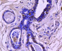 BAD Antibody in Immunohistochemistry (Paraffin) (IHC (P))