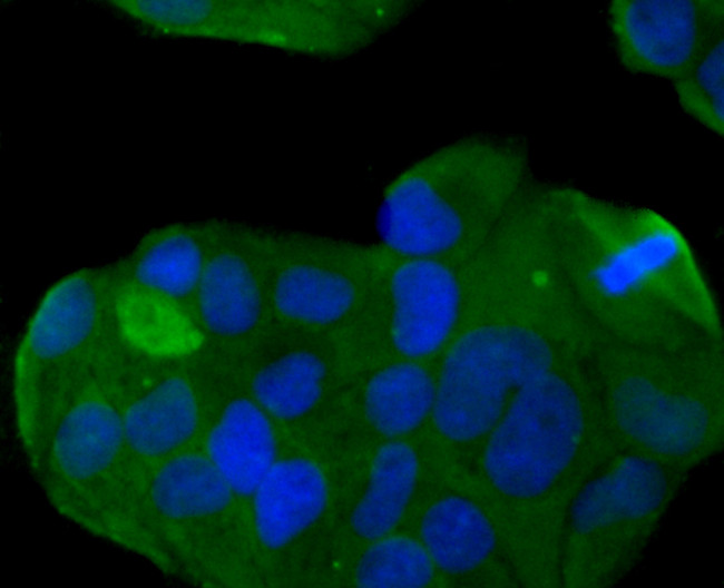 B7-H4 Antibody in Immunocytochemistry (ICC/IF)